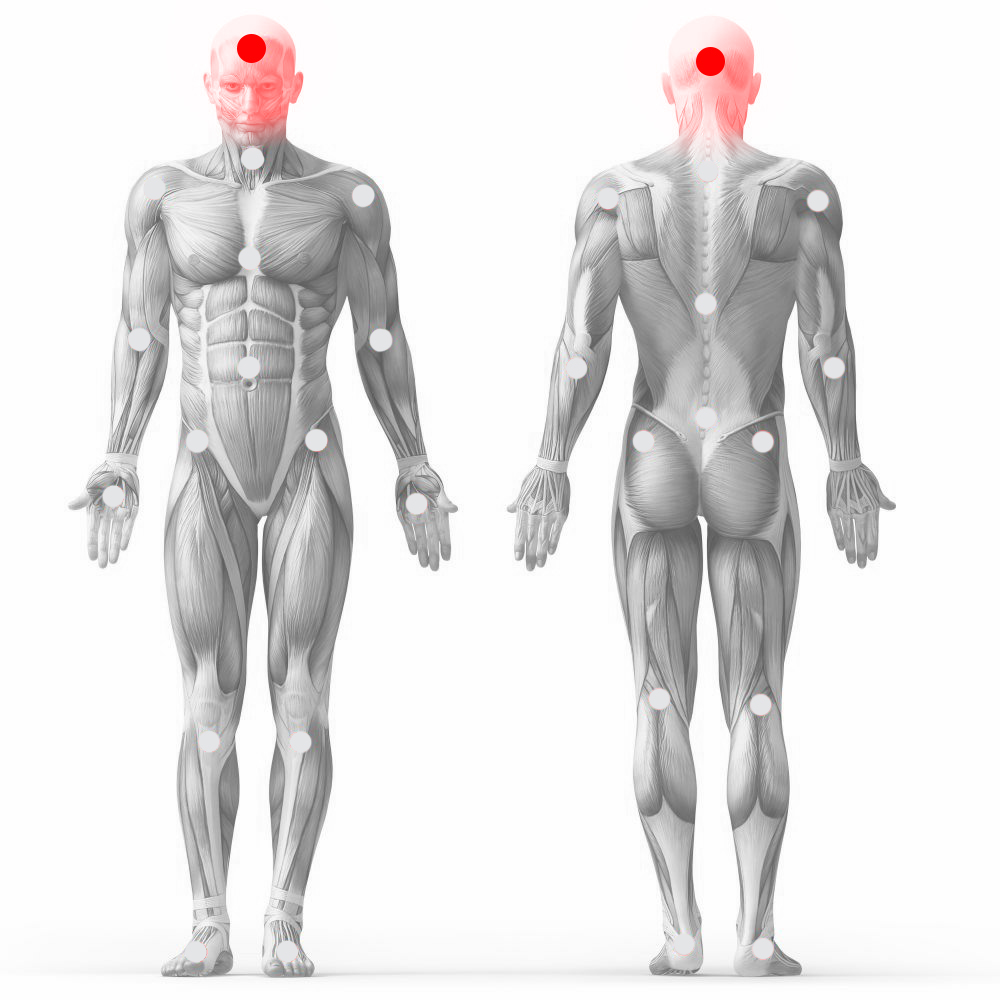 EasyFitt - Fejfájás elleni terápiák