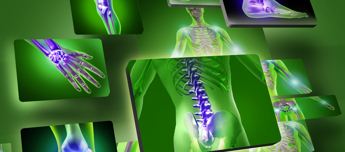 EasyFitt mozgásterápiák